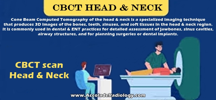 CBCT scan Head and Neck