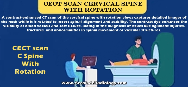 CECT scan Cervical Spine With Rotation Views