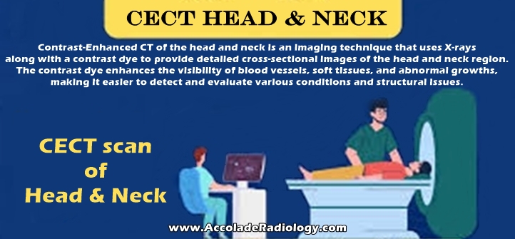 CECT scan Head and Neck