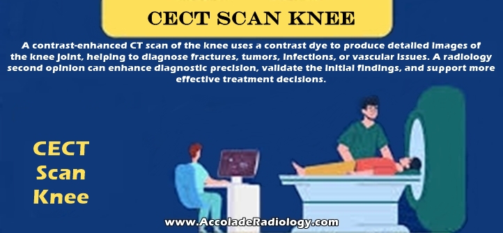 CECT scan of knee