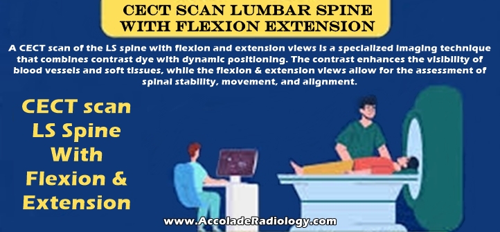 CECT scan of lumbar spine with flexion and extension views