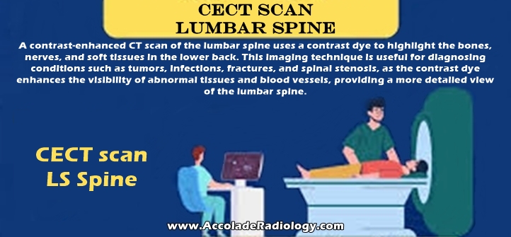 CECT scan Lumbar Spine