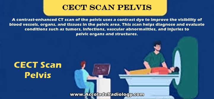 CECT scan of pelvis