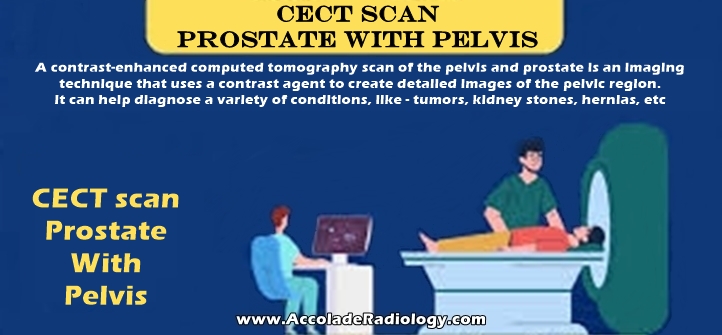 CECT scan of prostate and pelvis