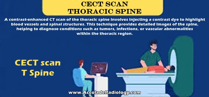 CECT scan Thoracic Spine