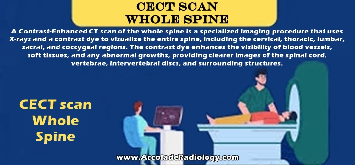 CECT scan whole spine