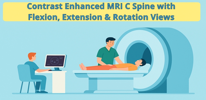 Contrast MRI Cervical Spine With Flexion Extension and Rotation Views