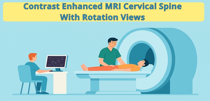 Contrast Enhanced MRI Cervical Spine With Rotation Views