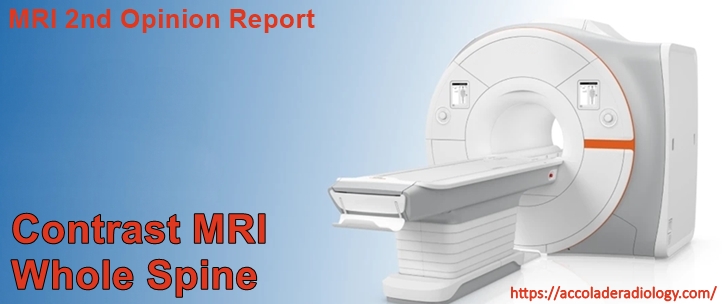 MRI Whole Spine with Contrast