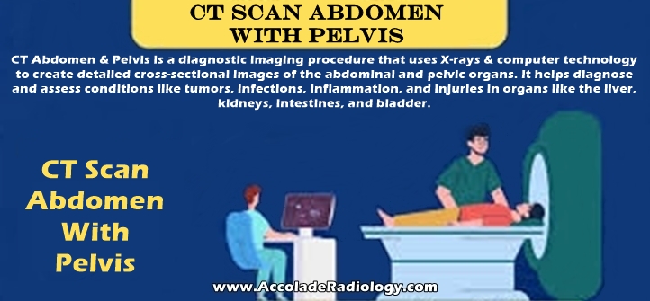 CT scan of abdomen and pelvis