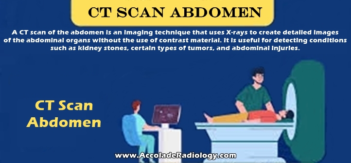 CT scan of abdomen