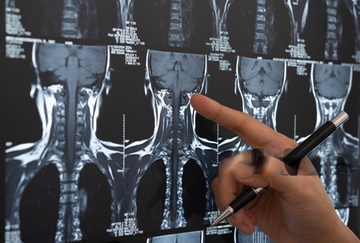 CT scan Cervical Spine