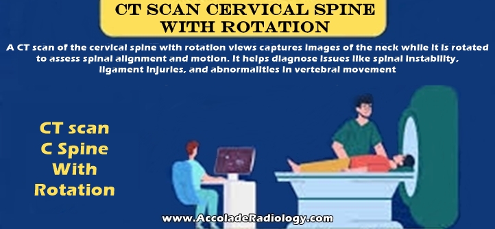 CT scan Cervical Spine With Rotation Views