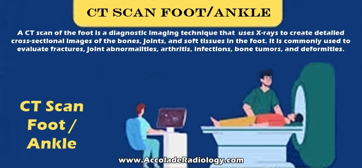 CT scan of ankle/foot