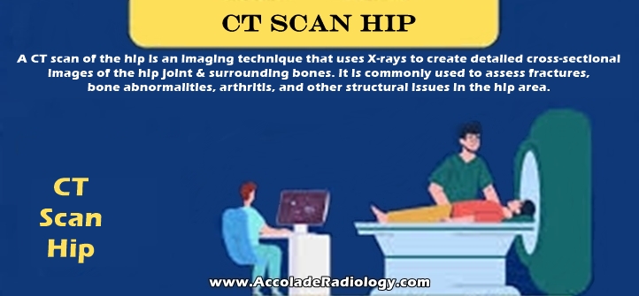 CT scan of hip