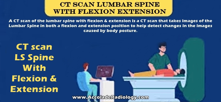 CT scan of lumbar spine with flexion and extension views