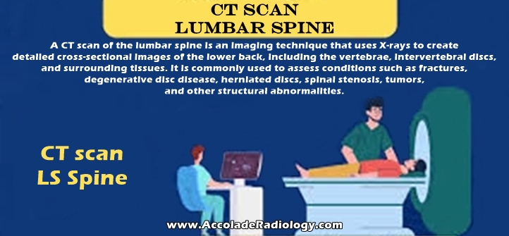 CT scan Lumbar Spine