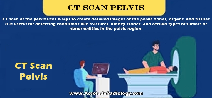 CT scan of pelvis