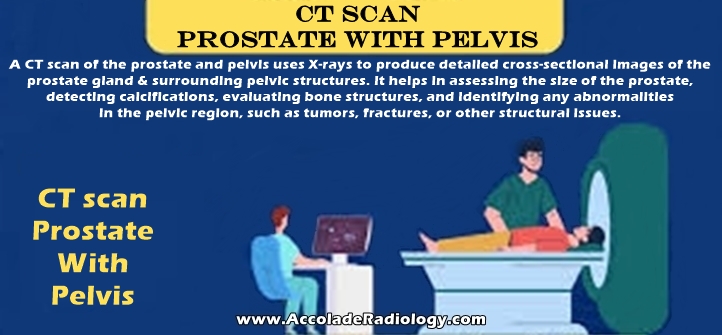 CT scan of prostate and pelvis