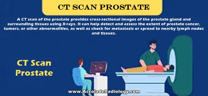 CT scan of prostate