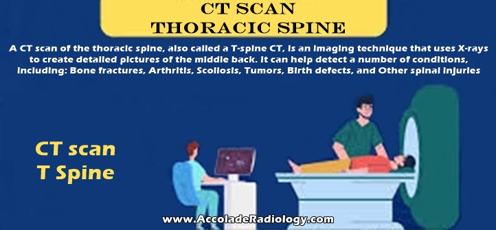 CT scan Thoracic Spine