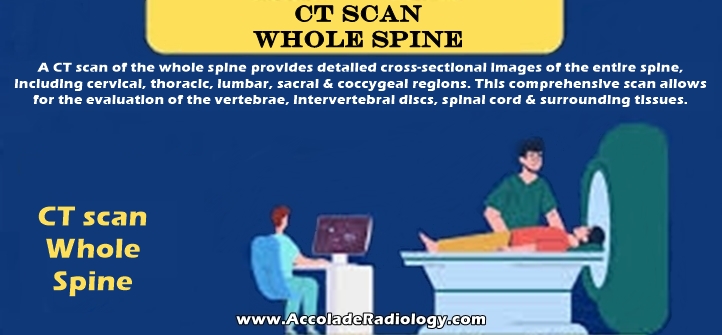 CT scan whole spine