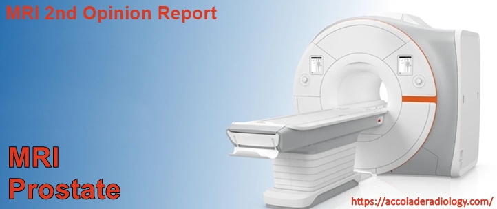 MRI Prostate