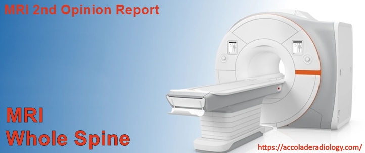 MRI Whole Spine